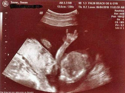 Heavy Metal Baby lustig macht Hornzeichen auf Ultraschallbild Heavy Metal Baby lustig macht Hornzeichen auf Ultraschallbild